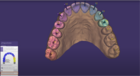 Watch our training video section about the Automation of the bite splint design