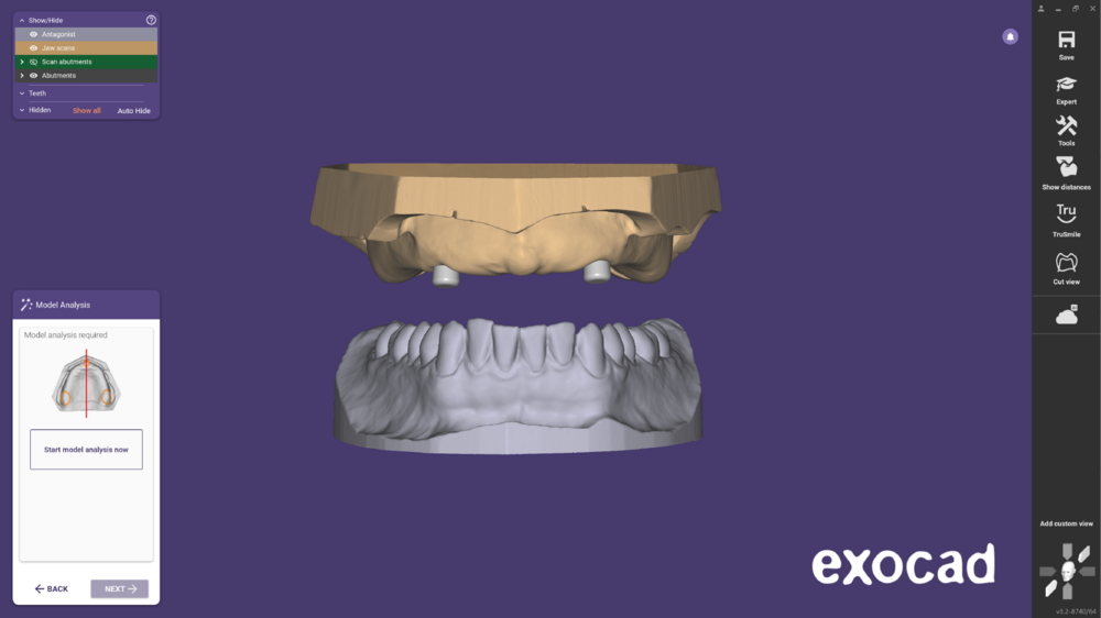 Ball attachment-03.png