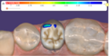 Thumbnail for version as of 16:06, 28 September 2022