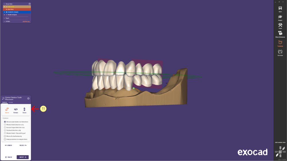 Denture remove teeth4-03 3.1.png