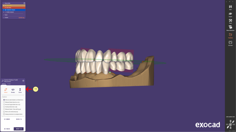 File:Denture remove teeth4-03 3.1.png