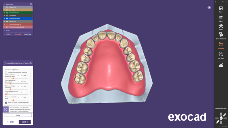File:Ball attachment-12.png
