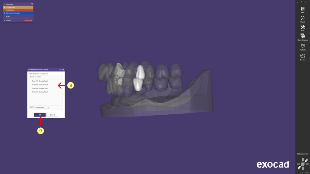 Denture remove teeth4-06.png