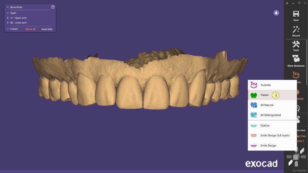 TruSmile-04.png