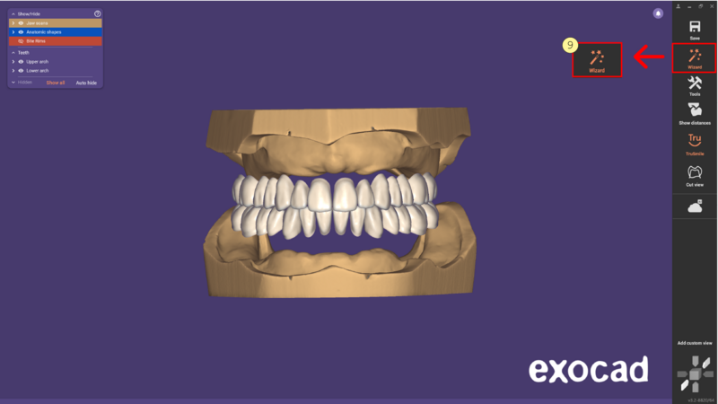File:3.2 Preset -06.png