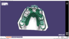Designing a Removable Partial Framework