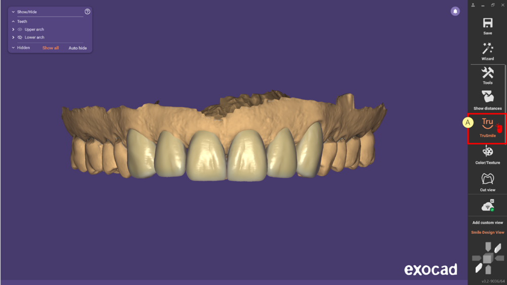 TruSmile-11.png