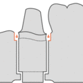 Thumbnail for version as of 19:47, 14 September 2022