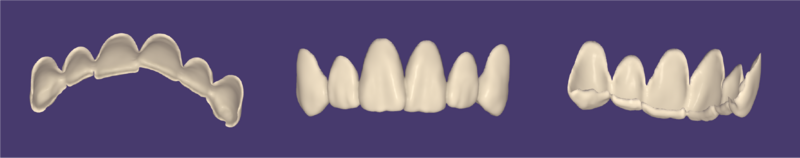 File:Mock up 3.1-12b.png