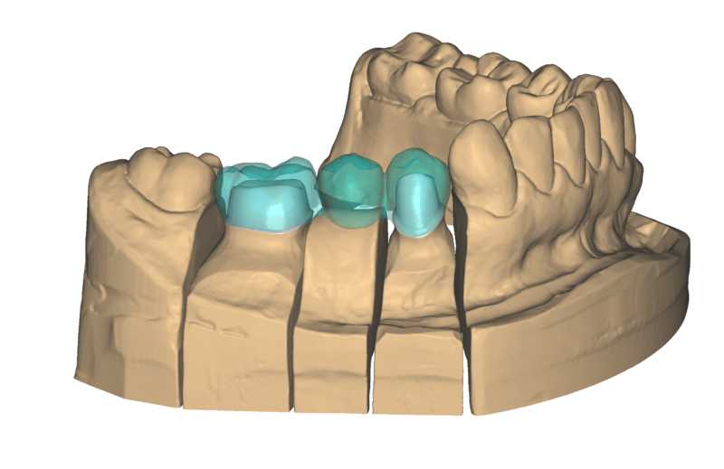 File:Pre-op1.png