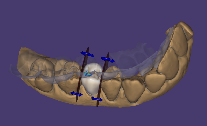 File:FreeFormingADAPTApprox-011.png