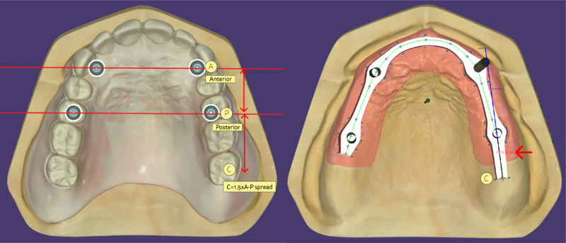 File:Bar cantilever.png