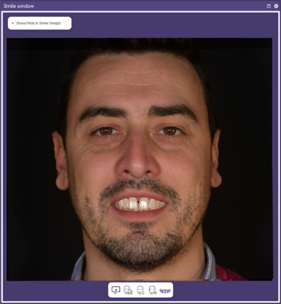 Smile window 1 3.2.png