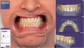 Thumbnail for version as of 10:20, 15 June 2021