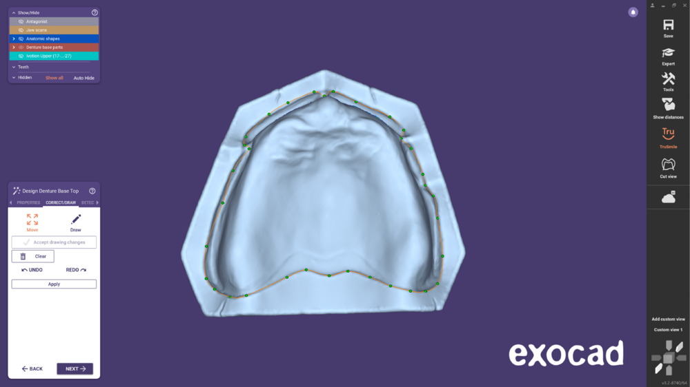 Ivotion dentalCAD-12.png