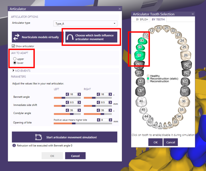 File:Arti-lower.png