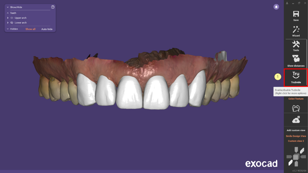 TruSmile-02.png
