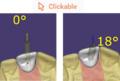 Thumbnail for version as of 14:13, 30 August 2021