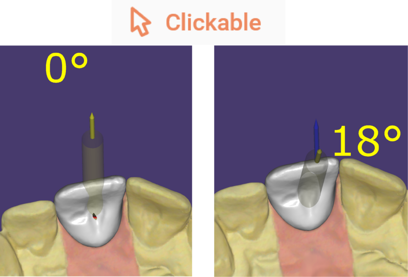 File:Clickable Galway.png
