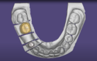 Copying teeth