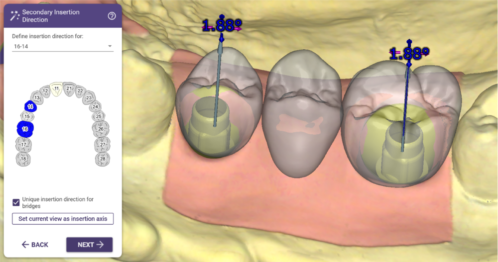 Define insertion 1.png