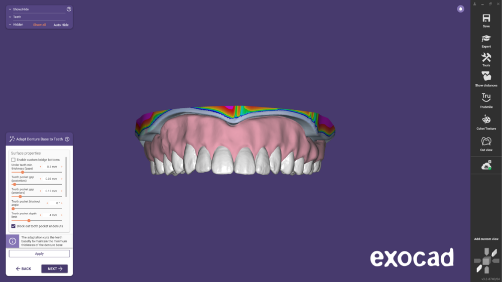 Duplicate denture -04.png
