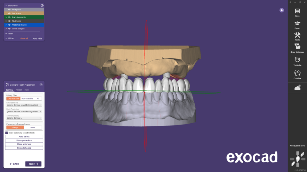 Ball attachment-04.png