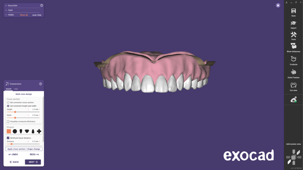 Duplicate denture -02.png