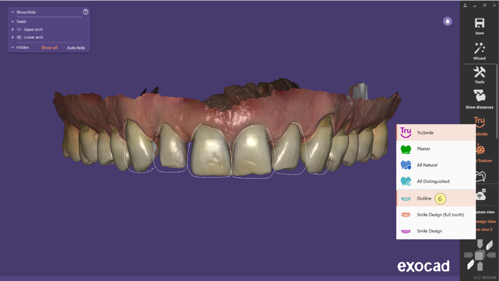 TruSmile-07.png