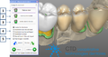 Thumbnail for version as of 17:43, 20 April 2012
