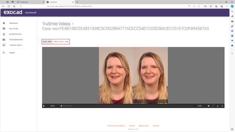 File:TruSmileVideo-11.png