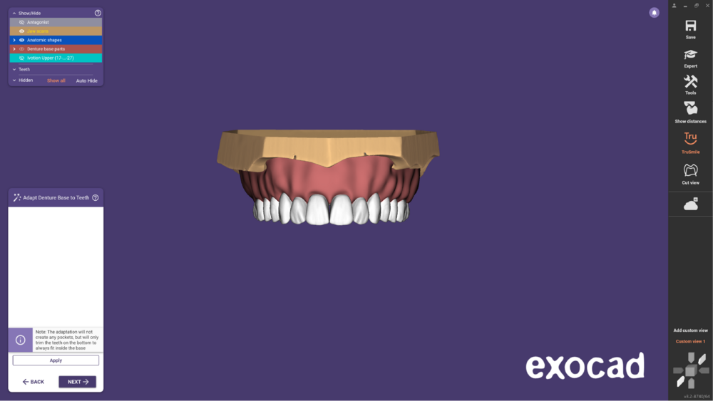 Ivotion dentalCAD-15.png