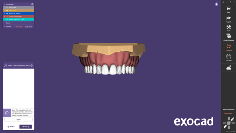 File:Ivotion dentalCAD-15.png