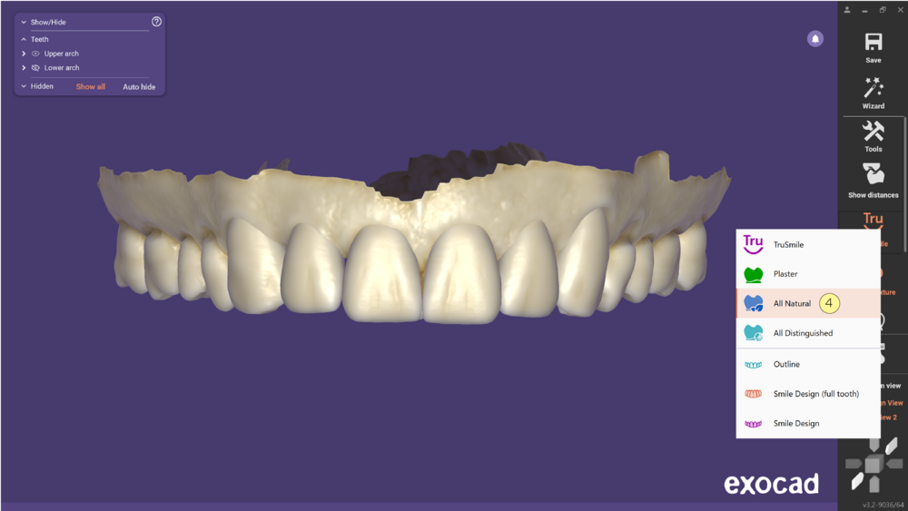 TruSmile-05.png