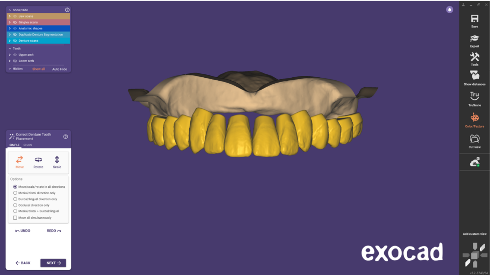 Duplicate denture-11.png
