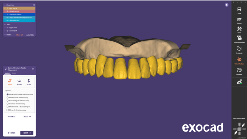 File:Duplicate denture-11.png