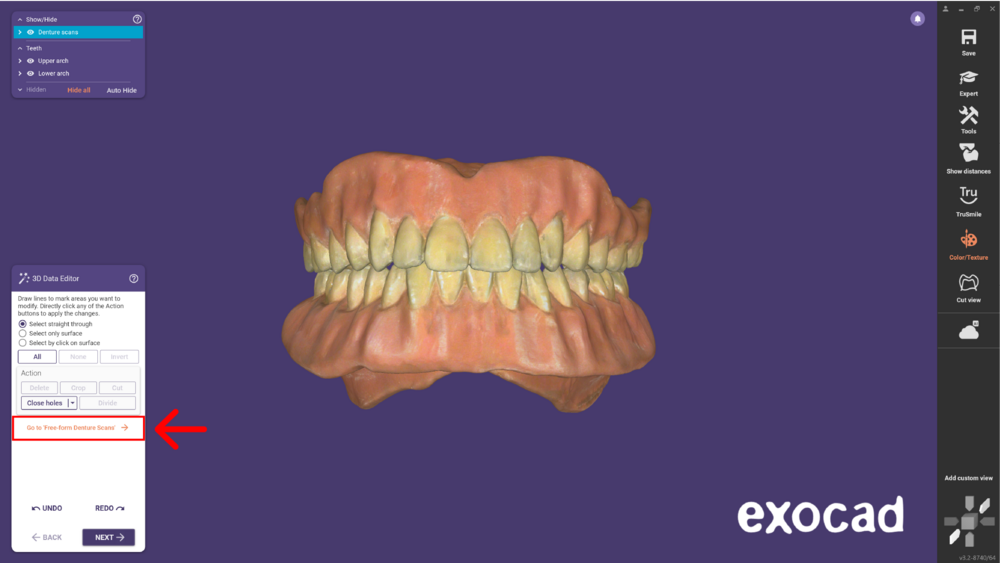 Duplicate denture-05.png