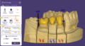 Thumbnail for version as of 08:53, 7 March 2024