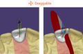 Thumbnail for version as of 14:13, 30 August 2021