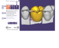 Thumbnail for version as of 18:00, 30 September 2014