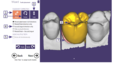Thumbnail for version as of 23:46, 6 October 2014