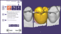 Thumbnail for version as of 21:43, 4 February 2015