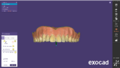 Thumbnail for version as of 16:55, 9 January 2024