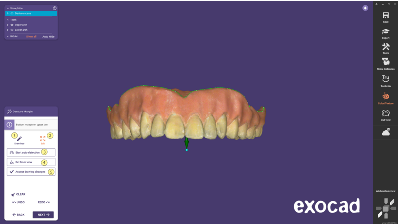 File:Duplicate denture-07.png