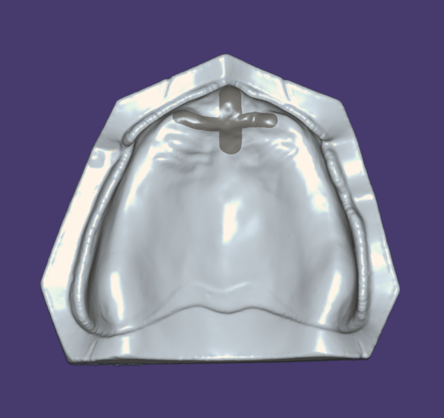 File:DentureOffset.png