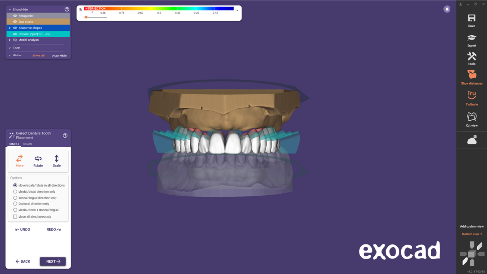 Ivotion dentalCAD-08.png
