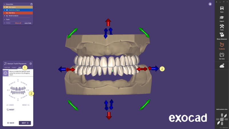 File:3.2 Preset -11.png