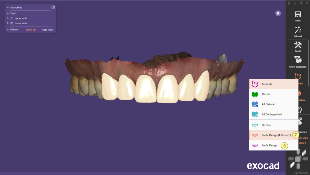 TruSmile-08.png
