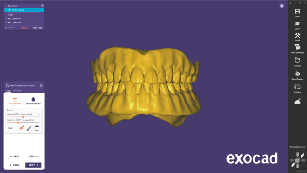 Duplicate denture-06.png