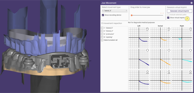 File:Jaw movement-08 3.2.png